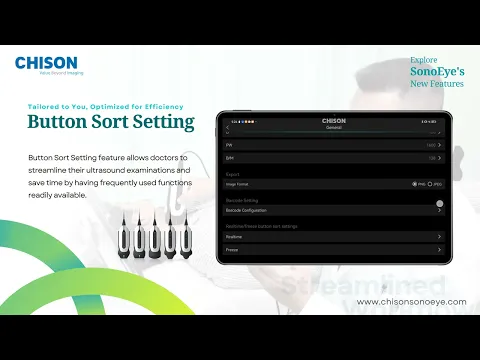 SonoEye Operation Guide-Button Sort Setting