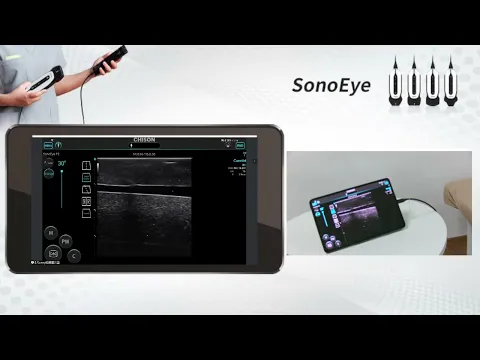 SonoEye Operation Guide-Super needle