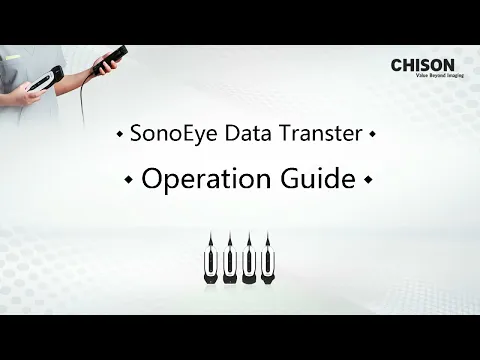 SonoEye Operation Guide-Data Transter